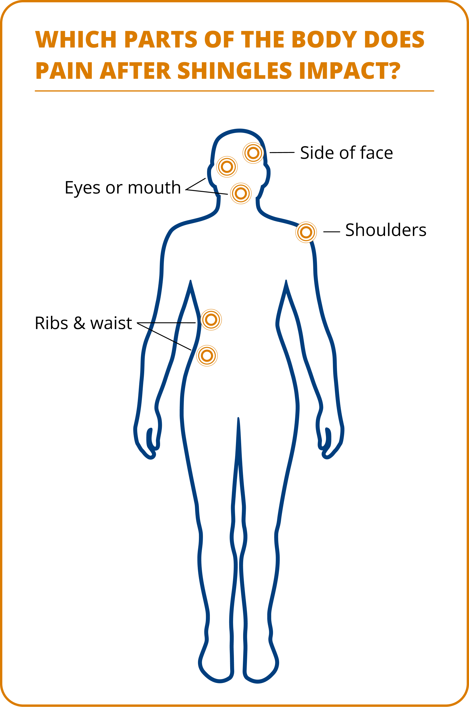 Diagram showing parts of the body affected by pain after shingles, including the side of the face, eyes or mouth, shoulders, and ribs and waist