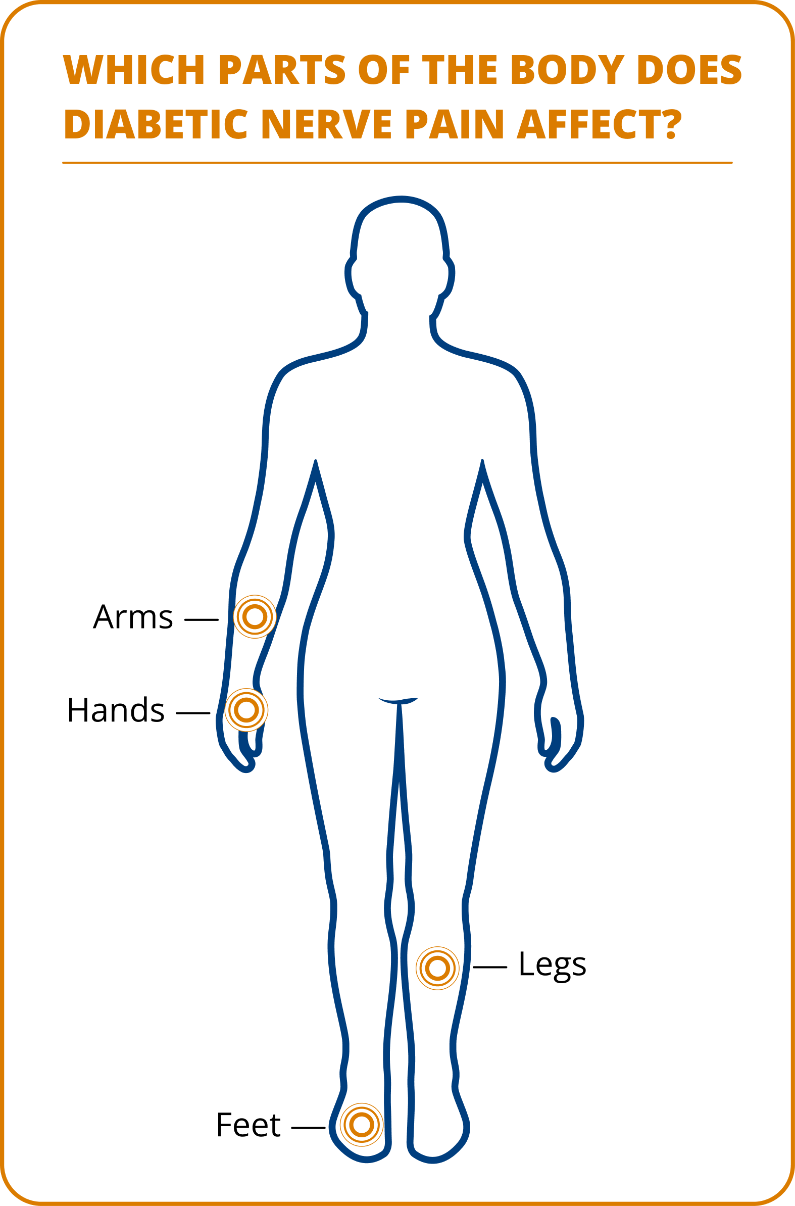 Diagram showing parts of the body affected by diabetic nerve pain, highlighting arms, hands, legs, and feet