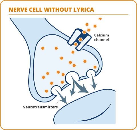 Diagram comparing nerve cells without and with LYRICA