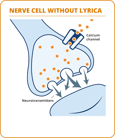 Diagram comparing nerve cells without LYRICA